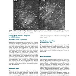 Making the Diagnosis: A Practical Guide to Breast Imaging: Expert Consult – Online and Print