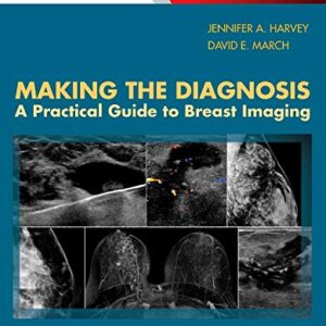 Making the Diagnosis: A Practical Guide to Breast Imaging: Expert Consult – Online and Print